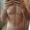 Post Op - 7 weeks - Including scar.