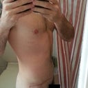 Post Op - 7 weeks - Including scar.
