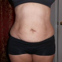 Front side very swollen still