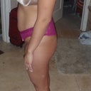 side view right before surgery.