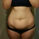 front before