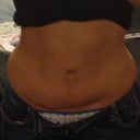 Here is a better prior picture. This was the day before.