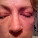 2 months after