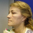 After, check out the extra smile line not there before and the extra lines around my mouth -- ALSO not there before!