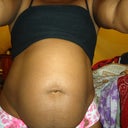 Tummy Tuck pre-op Awful!!!!!!!!