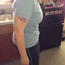1 week post op.
