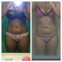 Pre op/ post op day 14