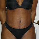 Front- 3WPO