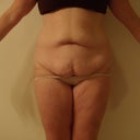 Front 8/12