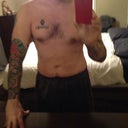 2 weeks Post Op: Front