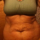 week before surgery