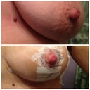 Just really want to point out the difference, look at that mole.. So much lift!