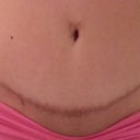 Tummy, middle section the darkest and slightly raised