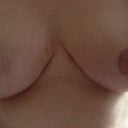 5 weeks post op