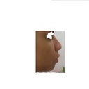 BEFORE PROFILE