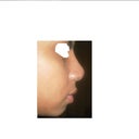 AFTER PROFILE (8 WEEKS)