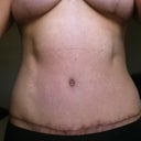 12 Weeks PO
