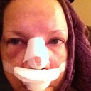 Day 2--worst day EVER (allergic to narcotics, so pitiful pain relief options)