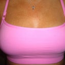 12 Days Post-Op
