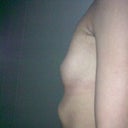 still a bit swollen