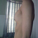 250cc breast implants