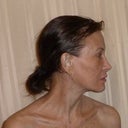 Five years post-op, no makeup, age 58