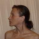 Five years post-op, no makeup, age 58