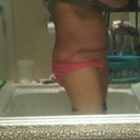 1 week post-op