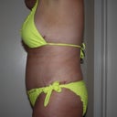 7 weeks post-op...still swollen!