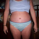 11-22-11 3 weeks post op ~ still really swollen