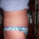 11-22-11 3 weeks post op ~ still really swollen