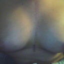 Day 6 Post op