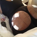 Post-op Day1