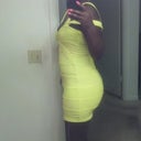 4 week 2 days post op...no compression garment...