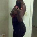 4 week 2 days post op...no compression garment...