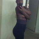 4 week 2 days post op...no compression garment...