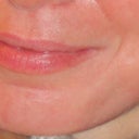 Before ePrime procedure