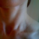 Day 75 after ePrime procedure (using elure Advanced Skin Lightening and one Vitalize peel)