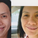 Before & After 2
