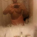 Three months after surgery. Sorry for the poor quality.