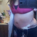 Week 2 - See the dent right above my hip? It's concave inwards