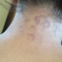 (Back of my neck)