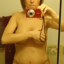 MARCH 14th 2012-Post Op day 9 - scar freaks me out and Im not very hour glass shapey yet :(