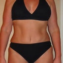 11 weeks PO! Same suit as original pics.  I really don't think I look any different from 10 days PO!