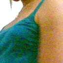 Before augmentation about 2007