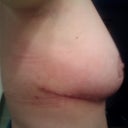 6 weeks side view