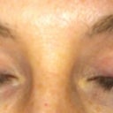 After latisse, notice brow growth too!  No make up.