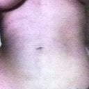 tummy coming together. if i lay on it for a few hours it become flat. belly button looks weird but i dont care lol