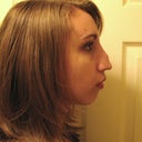 After surgeries 1 and 2.