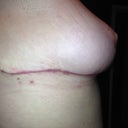 side view at almost 8 weeks
